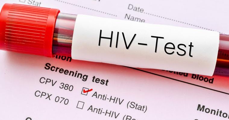 One thousand and seventy two persons, made up of 636 females and 436 males in 2019, tested positive to the Human Immunodeficiency Virus (HIV) in Tema.