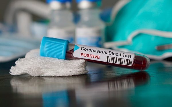 Ghana's coronavirus case count hits 204