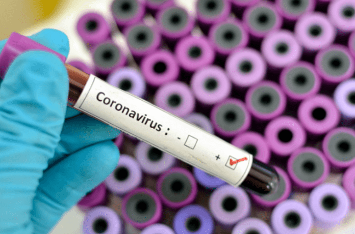 Coronavirus cases in Ghana hit 9