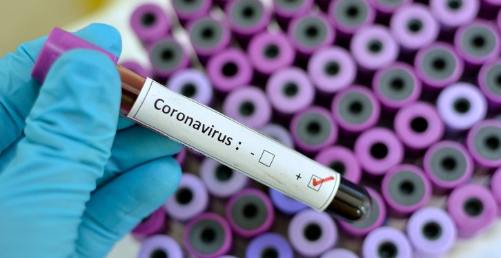 The number of Coronavirus cases in Ghana have risen to 11. More soon…