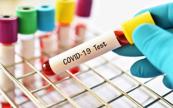COVID-19 cases in Ghana rise to 2,074, with 212 recoveries