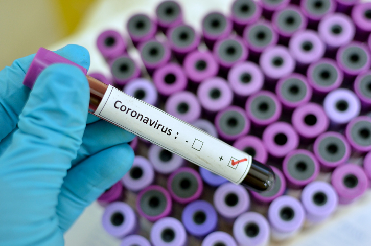 125 more cases of coronavirus recorded in Ghana, 24 new recoveries