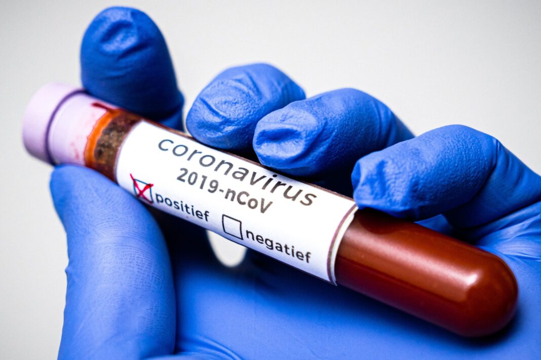 Coronavirus: Ghana’s Case Count Jumps to 287