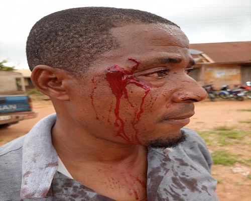 NPP Organiser seriously Injured after Attacked by unknown Thugs