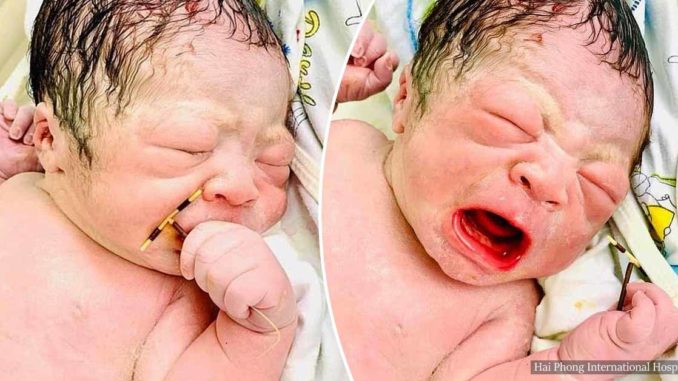 Newborn Baby Pictured Holding His Mother’s Failed Contraceptive Coil -PHOTOS