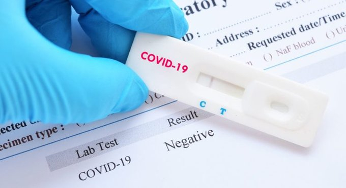 FDA must review mode of validating COVID-19 rapid test kits – GAMLS